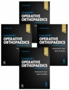 Campbell's Operative Orthopaedics 4-Volume Set, 14th Edition