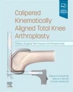 Calipered Kinematically aligned Total Knee Arthroplasty,1st Edition : Theory, Surgical Techniques and Perspectives