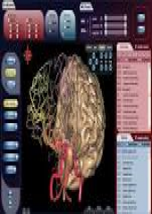 The Cerefy Atlas Of Cerebral Vasculature/CD-ROM