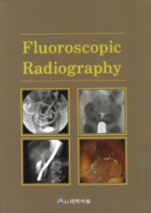 Fluoroscopic Radiography(투시조영)