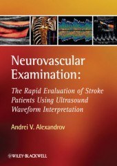 Neurovascular Examination: The Rapid Evaluation of Stroke Patients Using Ultrasound Waveform Interpretation