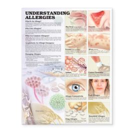 Understanding Allergies Anatomical Chart - Laminated 