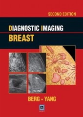 Diagnostic Imaging: Breast, 2/e