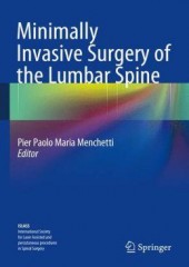 Minimally Invasive Surgery of the Lumbar Spine 