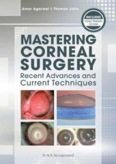 Mastering Corneal Surgery: Recent Advances and Current Techniques 