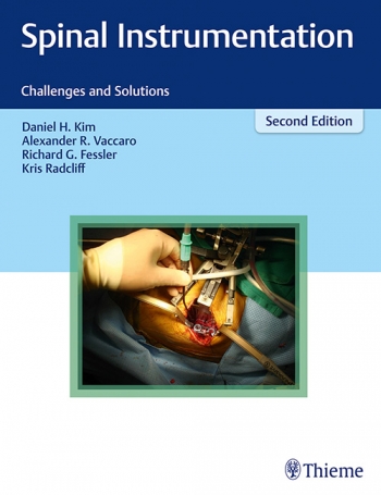 Spinal Instrumentation: Challenges and Solutions, 2/e