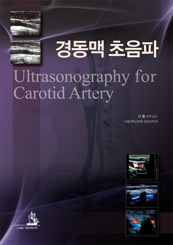 경동맥 초음파 Ultrasonography for Carotid Artery