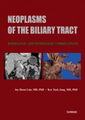 Neoplasms of the Biliary Tract : Radiologic and Pathologic Correlations