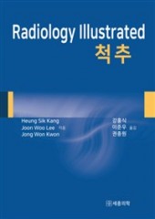 Radiology Illustrated: 척추