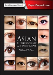 Asian Blepharoplasty and the Eyelid Crease, 3/e