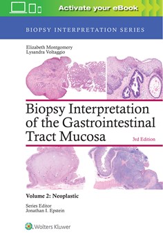 Biopsy Interpretation of the Gastrointestinal Tract Mucosa: Volume 2: Neoplastic, 3/e