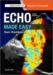 Echo Made Easy, 3/e