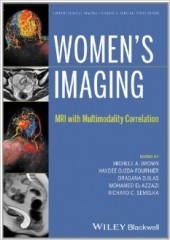 Women's Imaging: MRI with Multimodality Correlation 