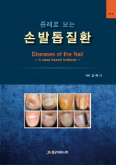 증례로 보는 손발톱질환-Diseases of the Nail, 2판