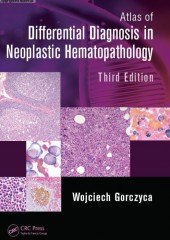 Atlas of Differential Diagnosis in Neoplastic Hematopathology, 3/e