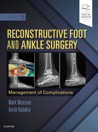 Reconstructive Foot and Ankle Surgery: Management of Complications, 3/e