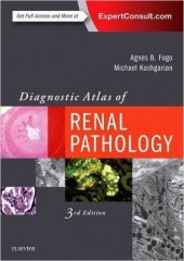 Diagnostic Atlas of Renal Pathology, 3/e