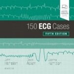 150 ECG Cases, 5/e