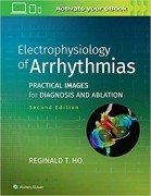 Electrophysiology of Arrhythmias: Practical Images for Diagnosis and Ablation 2/e