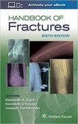 Handbook of Fractures, 6/e