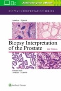 Biopsy Interpretation of the Prostate, 6/e