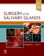 Surgery of the Salivary Glands, 1st Edition