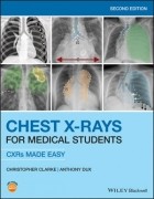 Chest X-Rays For Medical Students - Cxrs Made Easy 2Nd Edition