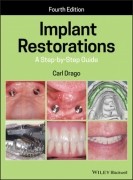 Implant Restorations - A Step-By-Step Guide