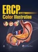 ERCP Color Illustration 2nd