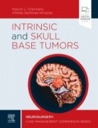 Intrinsic and Skull Base Tumors, 1st Edition