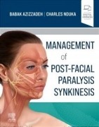 Management of Post-Facial Paralysis Synkinesis, 1st Edition