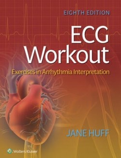 Add to Wish List ECG Workout Exercises in Arrhythmia Interpretation