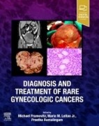 Diagnosis and Treatment of Rare Gynecologic Cancers, 1st Edition