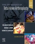 The Technique of Total Knee Arthroplasty, 2nd Edition