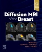 Diffusion MRI of the Breast, 1st Edition