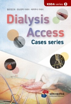 Dialysis Access - Case series /KSDA series 3