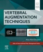 Vertebral Augmentation Techniques, 1st Edition