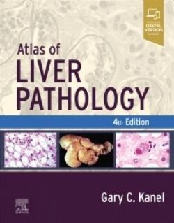 Atlas of Liver Pathology, 4th Edition