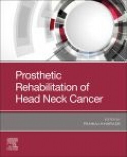 Prosthetic Rehabilitation of Head and Neck Cancer Patients, 1st Edition