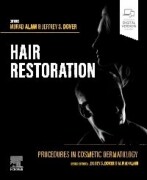 Procedures in Cosmetic Dermatology: Hair Restoration, 1st Edition