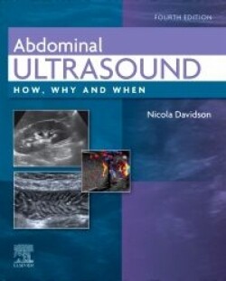 Abdominal Ultrasound, 4th Edition: How, Why and When