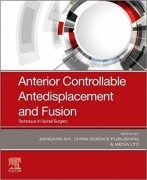 Anterior Controllable Antedisplacement and Fusion, 1st Edition Technique in Spinal Surgery