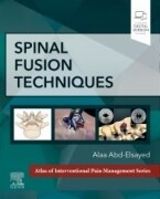 Spinal Fusion Techniques, 1st Edition