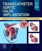 Transcatheter Aortic Valve Implantation, 1st Edition