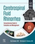 Cerebrospinal Fluid Rhinorrhea, 1st Edition Comprehensive Guide to Evaluation and Management