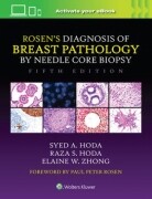 Rosen's Diagnosis of Breast Pathology by Needle Core Biopsy 5/e