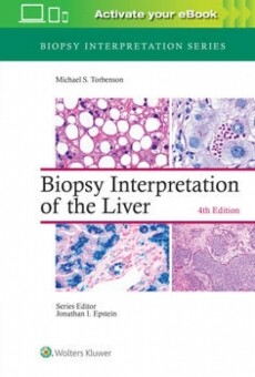 Biopsy Interpretation of the Liver 4/e