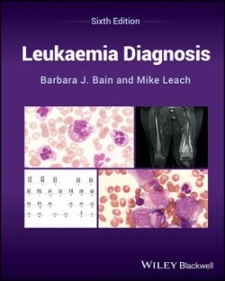 Leukaemia Diagnosis, 6th Edition