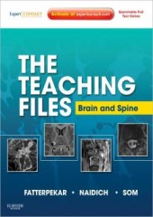 The Teaching Files: Brain And Spine Imaging