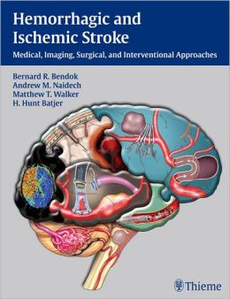 Hemorrhagic and Ischemic Stroke